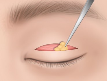 ������ �������� 2