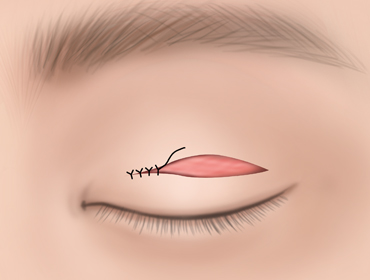 ������ �������� 3