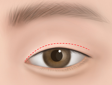 ������ ���ű��� 1