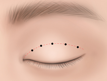 ������ ���ű��� 2