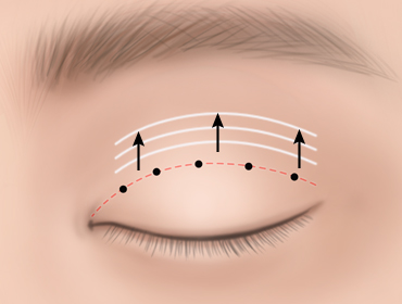 ������ ���ű��� 3