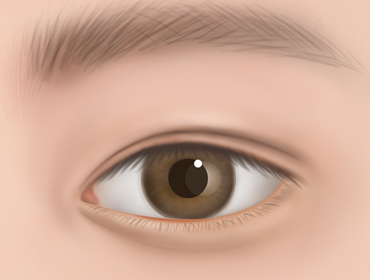 ������ ���ű��� 4