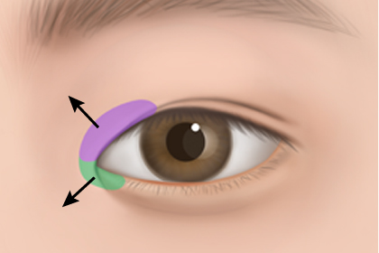 ���� ��Ʈ�� �������� 2