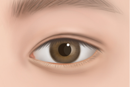 ���� ��Ʈ�� �������� 3