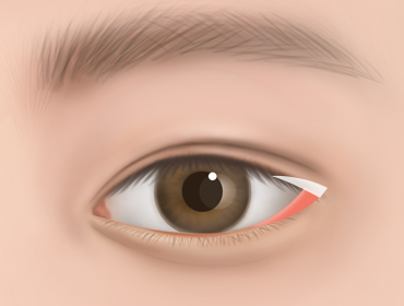 ������ �������� 2