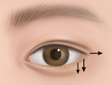 ������ �������� 3