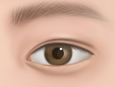 ������ �������� 4