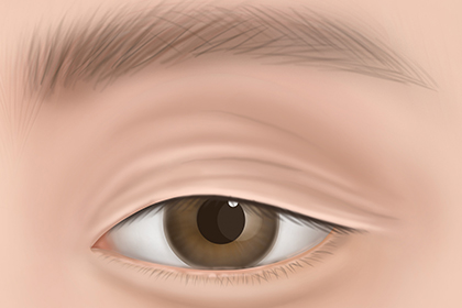 ����Ż�� ���� ��� 1