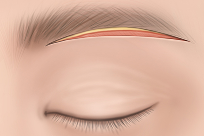 ����Ż�� ���� ��� 2