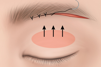 ����Ż�� ���� ��� 3