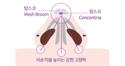 ž���� Tripod concent �ü�