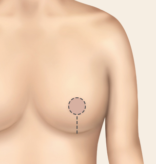 ������翡 ���� ������� �������A